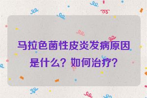 马拉色菌性皮炎发病原因是什么？如何治疗？